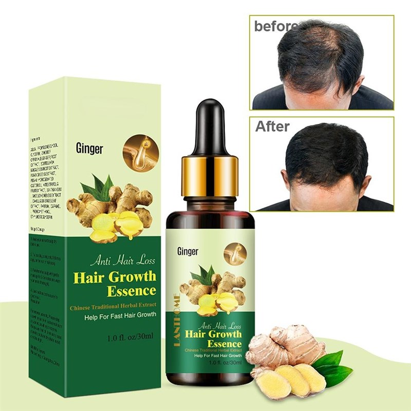 Women Hair Growth Essential Oil for ginger hair essence