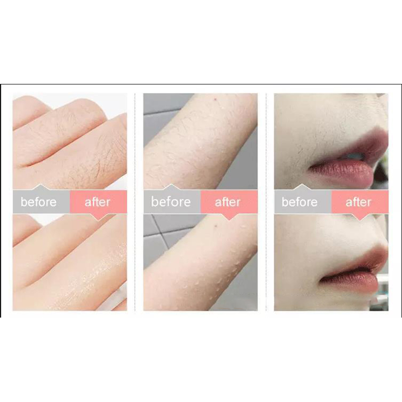 Laser Epil Permaet IPL Hr Remov electr shavig