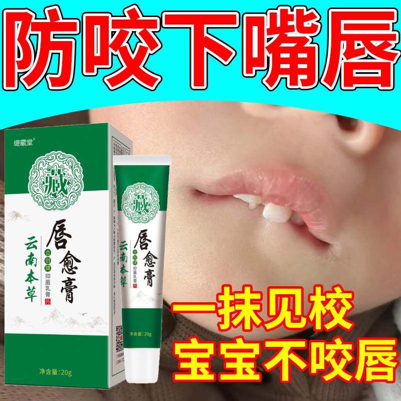 宝宝防咬下嘴唇纠正器改善小孩子口呼吸神器戒咬嘴唇矫正前庭盾膏