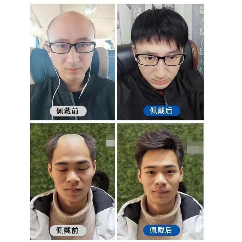 速发真发男士假发前额旋头顶补发片遮秃顶白发短发刘海真人造型