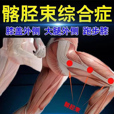 髂胫束综合症大腿外侧膝盖外侧疼痛下蹲困难腿疼专用膏贴舒筋活络