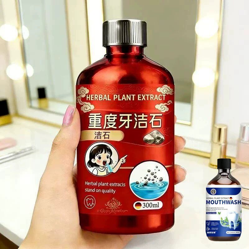 【重度牙结石】牙石溶解漱口水洗牙齿污垢牙垢牙黄牙渍清理通用