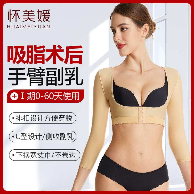 怀美媛一期手臂胳膊抽脂
