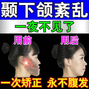 颞下颌关节紊乱热敷改善大小脸矫正神器防止下颚骨弹响下巴歪脱臼