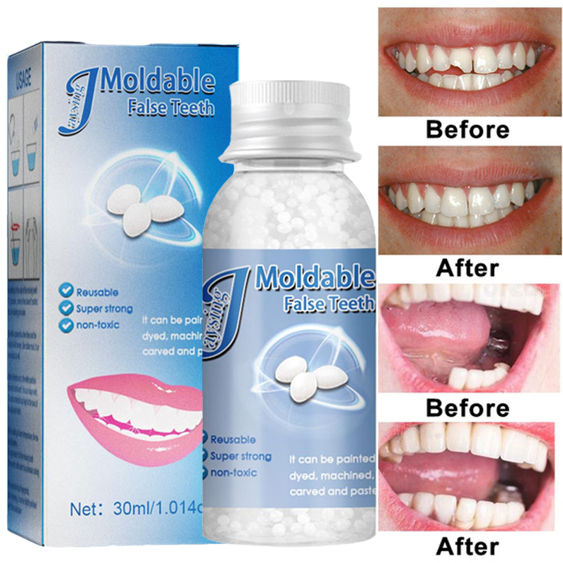 Dentes e gap dentes falsos slido cola resina faltando dent