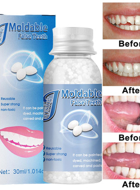 Dentes e gap dentes falsos slido cola resina faltando dent