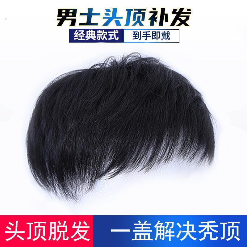 假发男短发头顶补发块秃顶地中海假发片贴男士毛寸彷真发韩版帅气
