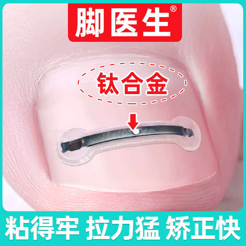 脚医生甲沟嵌甲矫正器炎正甲贴贴片脚趾指甲往肉里长专用指甲刀剪
