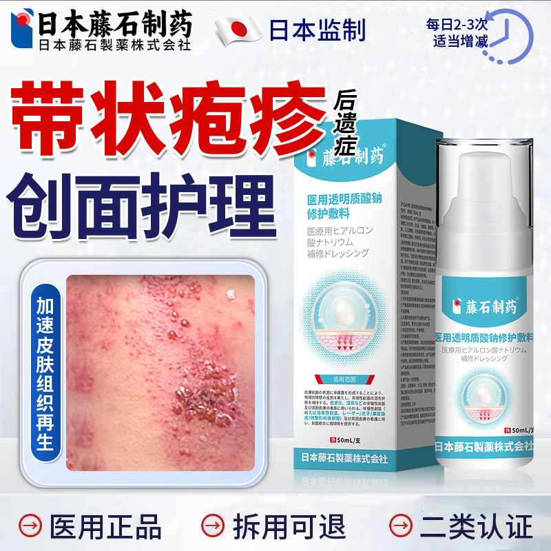 蛇盘疮带状疱疹后遗症神经痛特泡疹正品止痒疼断喷剂可搭膏药FT