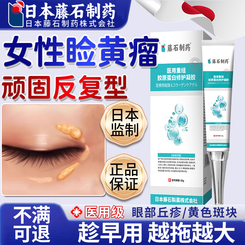 滕石去眼睑黄疣除眼睑黄色瘤药膏丘疹眼部眼角斑块瘤可搭膏药贴OM