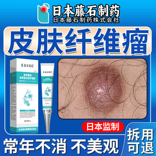 皮肤纤维瘤粉瘤痘痘去除皮下肿硬块拔毒脓皮脂腺囊肿膏药房同售FT