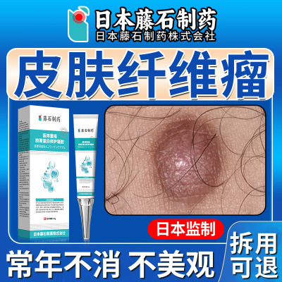 皮肤纤维瘤粉瘤痘痘去除皮下肿硬块拔毒脓皮脂腺囊肿膏药房同售OM
