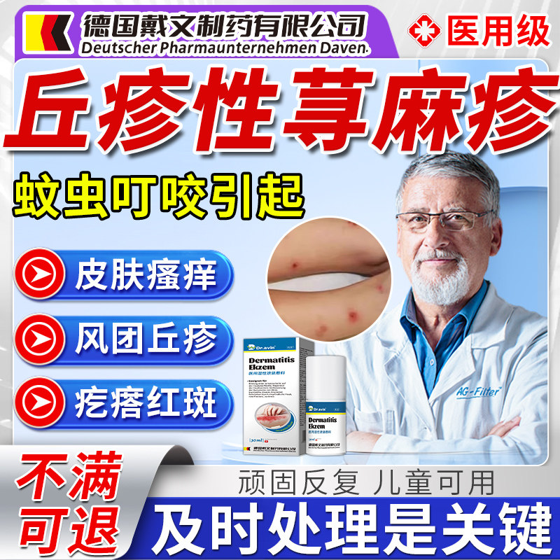 丘疹性荨麻疹蚊虫叮咬性皮炎螨虫儿童效抗敏止痒特专用喷雾OM