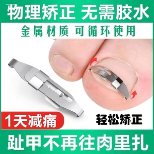 甲沟矫正器指甲矫正嵌甲神器纠正器脚趾甲贴片卷曲甲专用正甲扣炎