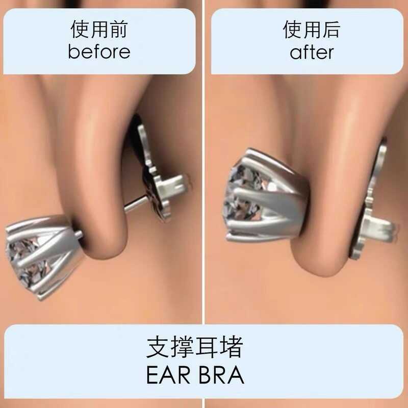 耳堵防掉支撑辅助器防下垂外翻耳钉神塞大耳环固定牵引提升耳骨扣
