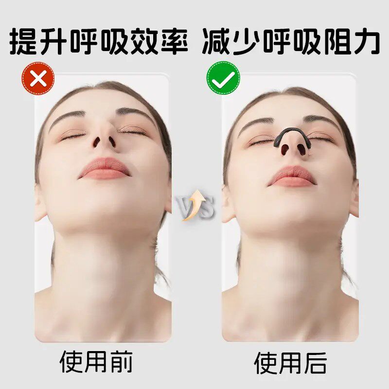 热销【下单立减30】外置磁吸鼻撑磁吸鼻带磁性扩张鼻孔睡眠运动打