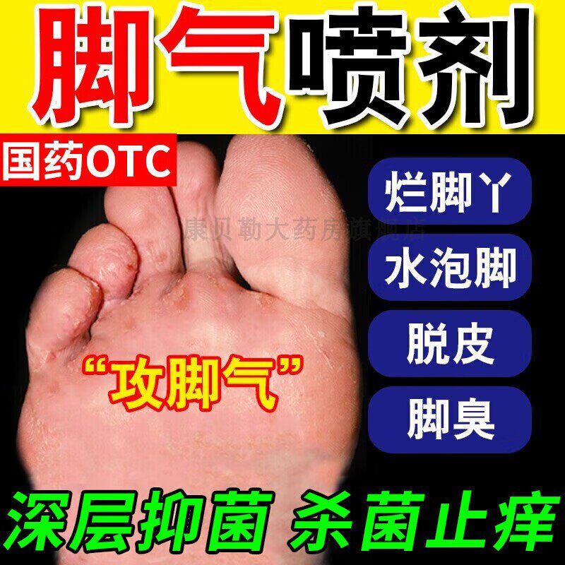 盐酸特比萘芬喷雾剂正品非达克宁搓搽剂止痒脱皮烂脚真菌感染mj