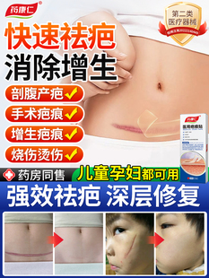 药康仁疤痕贴剖腹产手术医用硅酮凝胶修复瘢痕烧烫伤增生去疤贴Z2