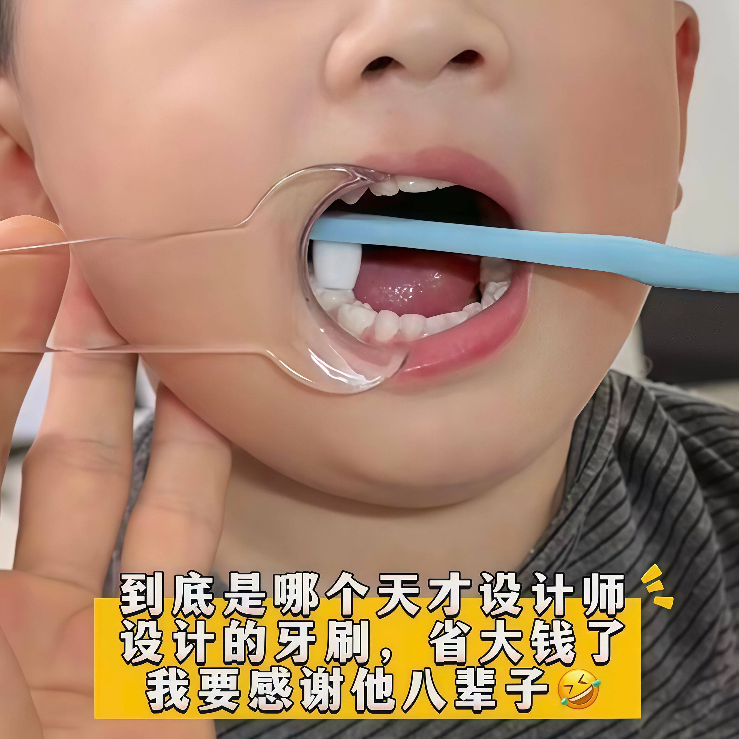 宝宝刷牙辅助器防咬嘴巴扩张器