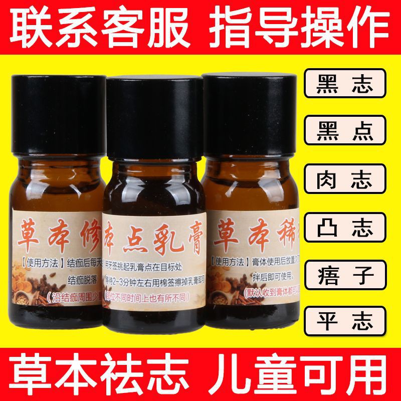 正品点痣膏无痕脸部无痛黑痣痦子斑点凸痣肉猴脖子颈部丝状疣神器