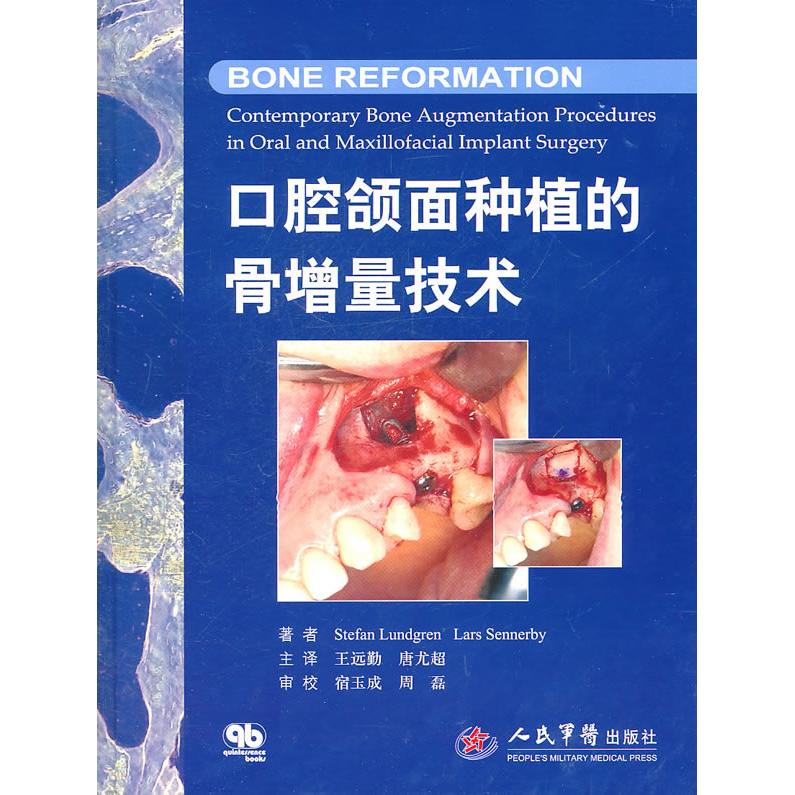 【正版书籍】口腔颌面种植的骨增量技术伦德格伦人民军医出版社