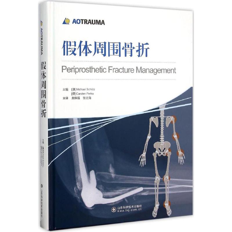 【正版书籍】假体周围骨折米歇尔舒茨卡斯滕博卡唐佩福山东科学技术出版社
