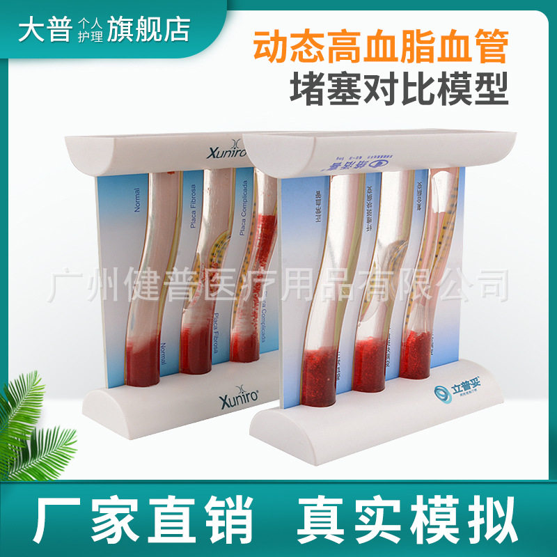 三支血管模型 动态高血脂血管堵塞对比模型 病态血管浓稠度对比
