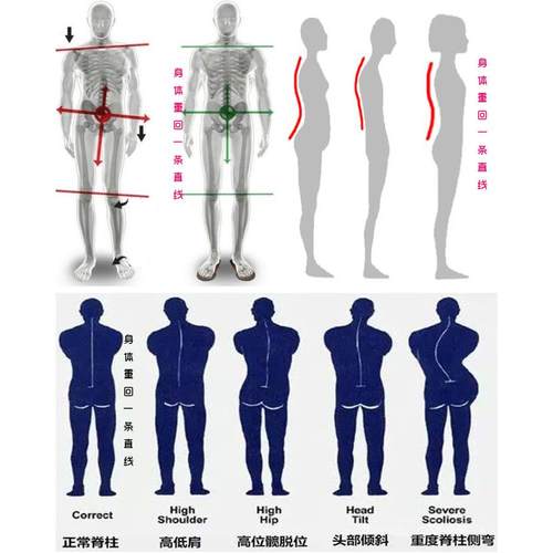 体衡体型仪脊柱侧弯娇姿带驼背长短腿骨盆倾斜旋转胸椎腰椎矫正器