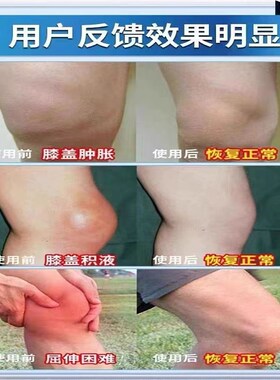 膝盖不适膏滑膜半月板关节积水积液老寒腿疼关节舒筋透骨贴膏