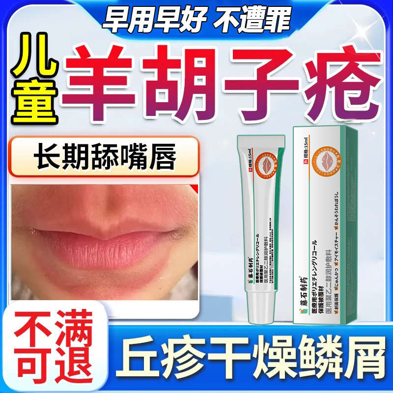 儿童羊胡子疮嘴巴一圈红舌舔唇炎嘴唇防干裂脱皮医用药监备案膏VZ