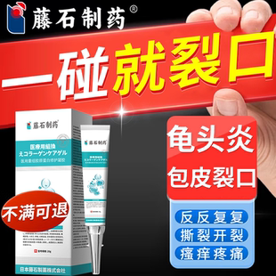 包皮开裂发炎裂口男性龟头炎真菌感染包皮过长后翻干裂伤口愈合VZ