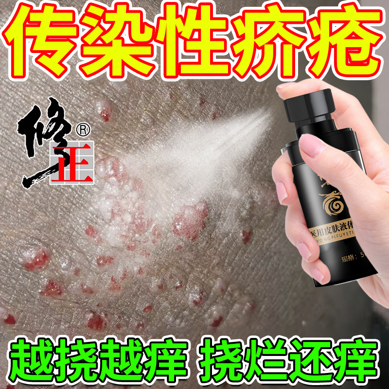 结节疥疮疥螨阴杀疥虫止痒消毒喷雾剂专用螨虫治皮肤芥疮介疮虫RW