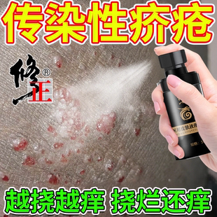结节疥疮疥螨阴杀疥虫止痒消毒喷雾剂专用螨虫治皮肤芥疮介疮虫RW
