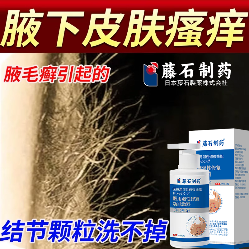 腋毛癣白色附着物腋窝去异味除腋下藓清洁根出汗咯吱窝痒沐浴露RW