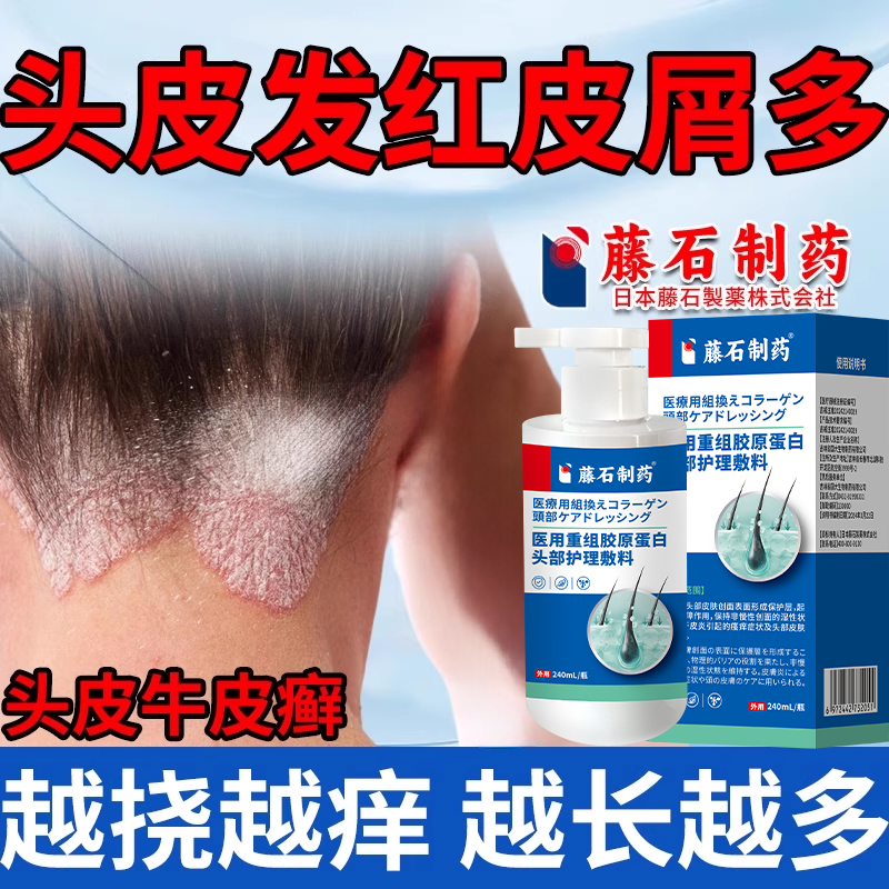 头皮发红皮屑多真菌感染头屑头痒顽固牛皮VZ