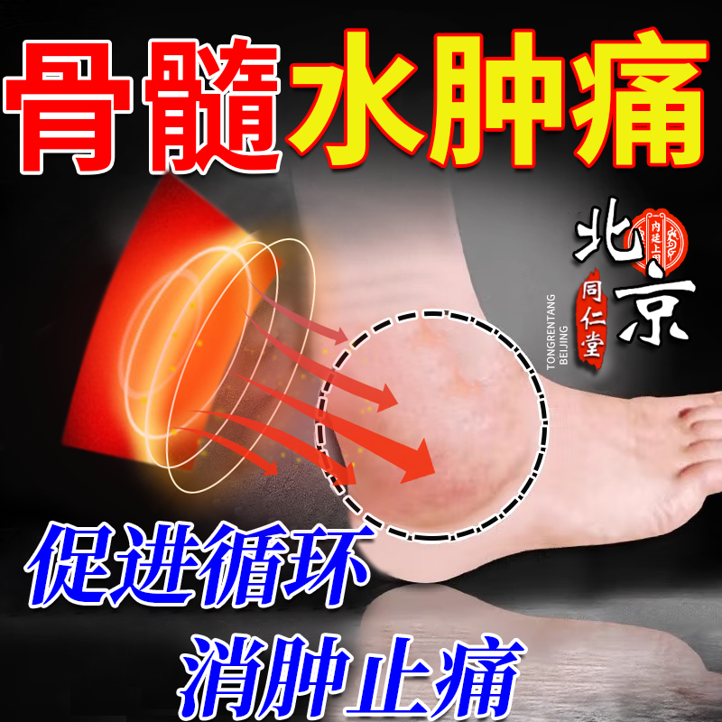 脚踝骨髓水肿膝盖手腕脚腕疼痛膏热敷韧带损扭伤滑膜炎关节积液RW
