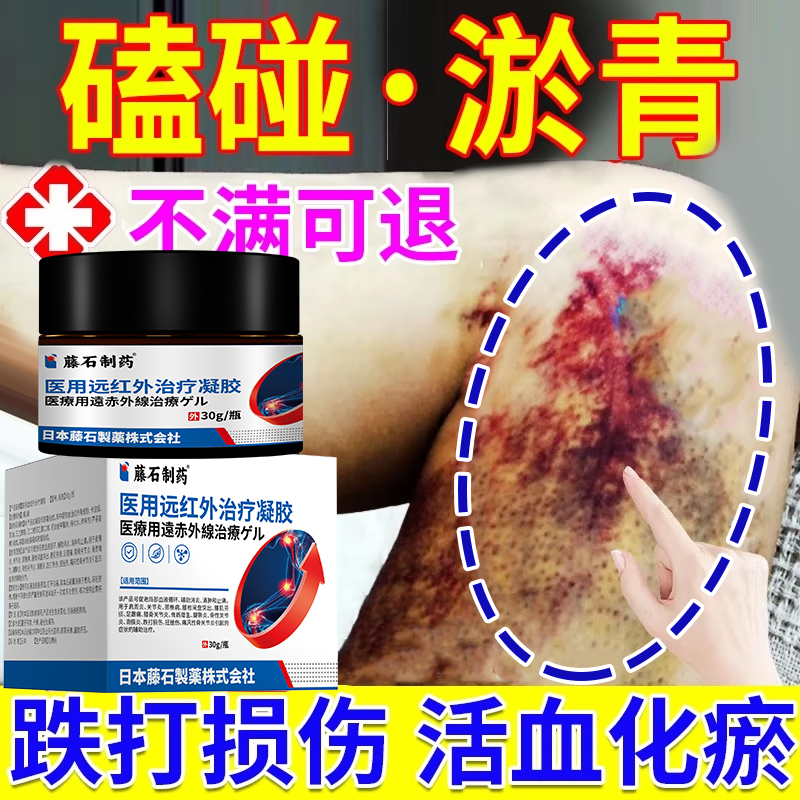 摔伤磕碰跌打损伤快速消肿止痛