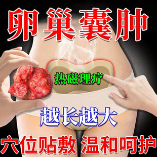 卵巢囊肿巧克力消除穴位调理中膏贴卵巢保养泡脚包子宫肌瘤附件rw