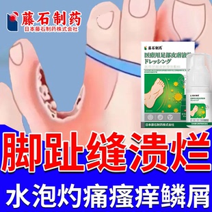 脚趾缝糜烂性溃烂开裂口脱皮痒脚气烂脚丫臭脚水泡真菌足癣喷雾RW