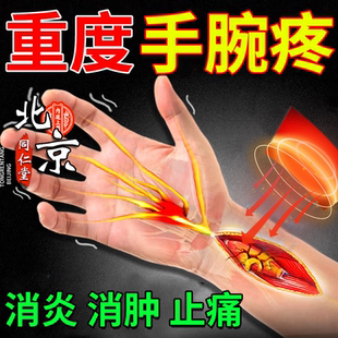 尺骨撞击综合征护腕tfcc三角软骨损伤手腕劳损退行性改变骨折贴RW