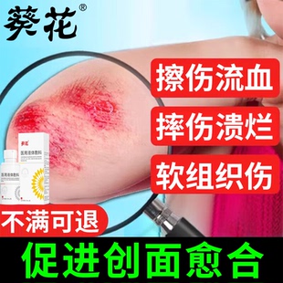 擦伤破皮肤外伤口愈合药膏促进长肉修复凝胶儿童医用液体止血RW
