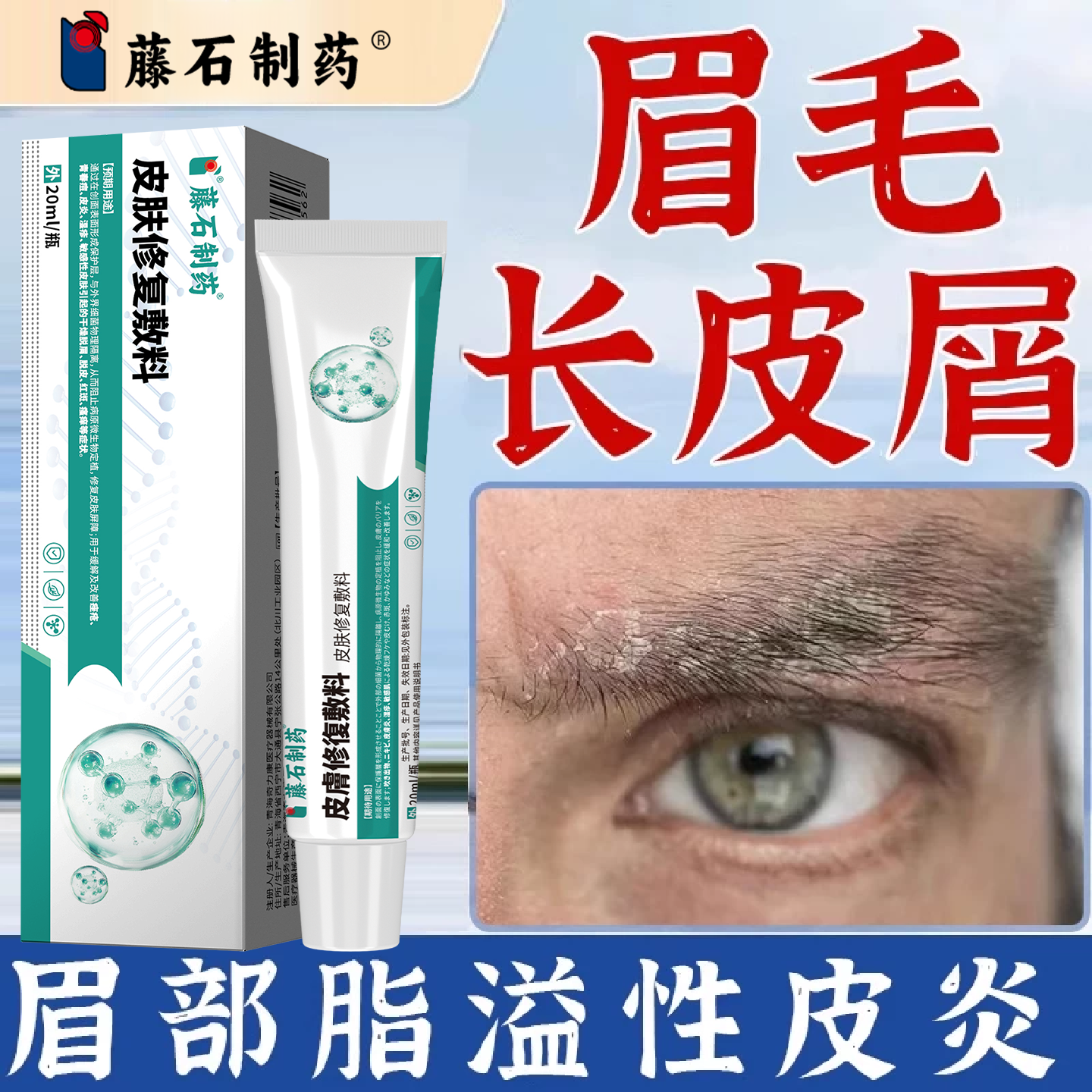 眉毛起皮脸脂溢性皮炎皮肤干燥掉屑额头红斑瘙痒脱皮大块皮癣ZN