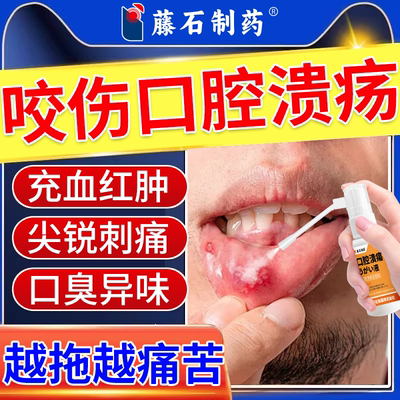 咬伤口腔溃疡烂肉消肿止痛溃烂肿痛剧痛吃饭困难含漱液喷雾剂VZ