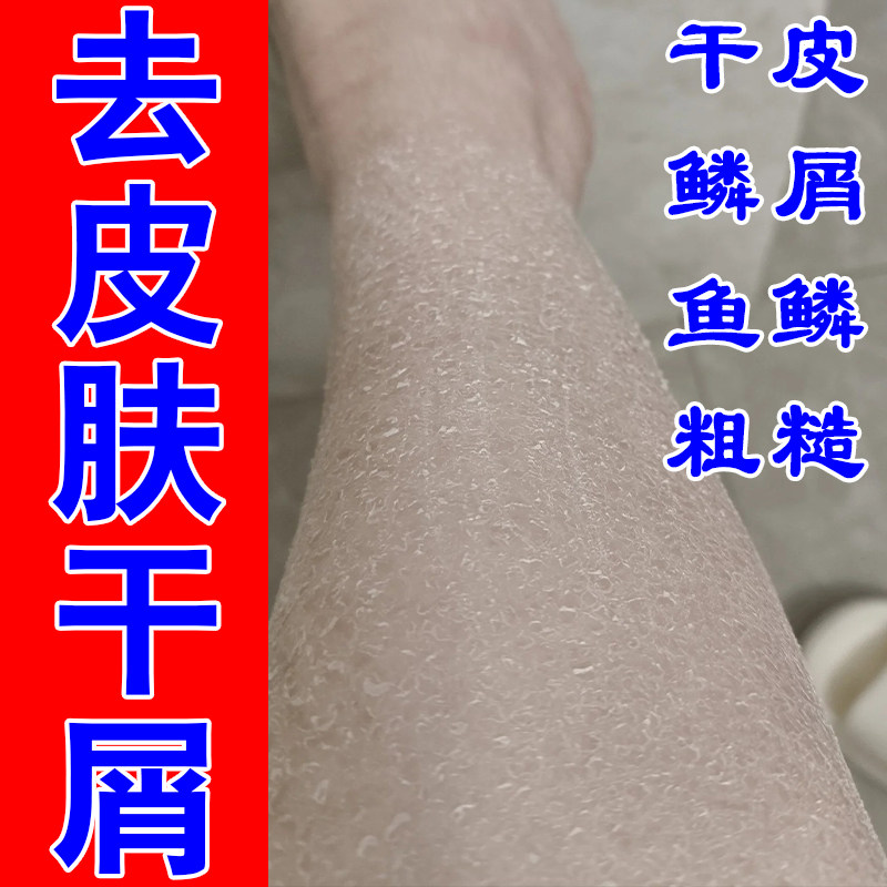 腿痒干燥起皮痒腿上干燥起皮腿部发痒红点干燥粗糙缺水保湿甘油