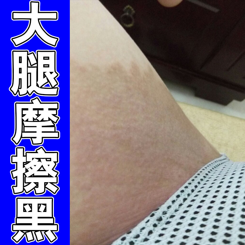 双腿内侧皮肤摩擦发黑干燥粗糙屁股臀部黑印修复舒缓膏