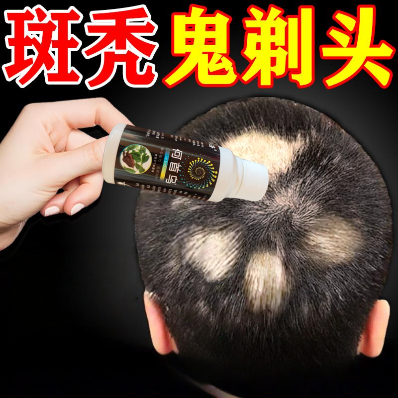 斑秃特效鬼剃头药防脱发毛囊激活生发液专用洗发水一抹灵遮盖喷剂