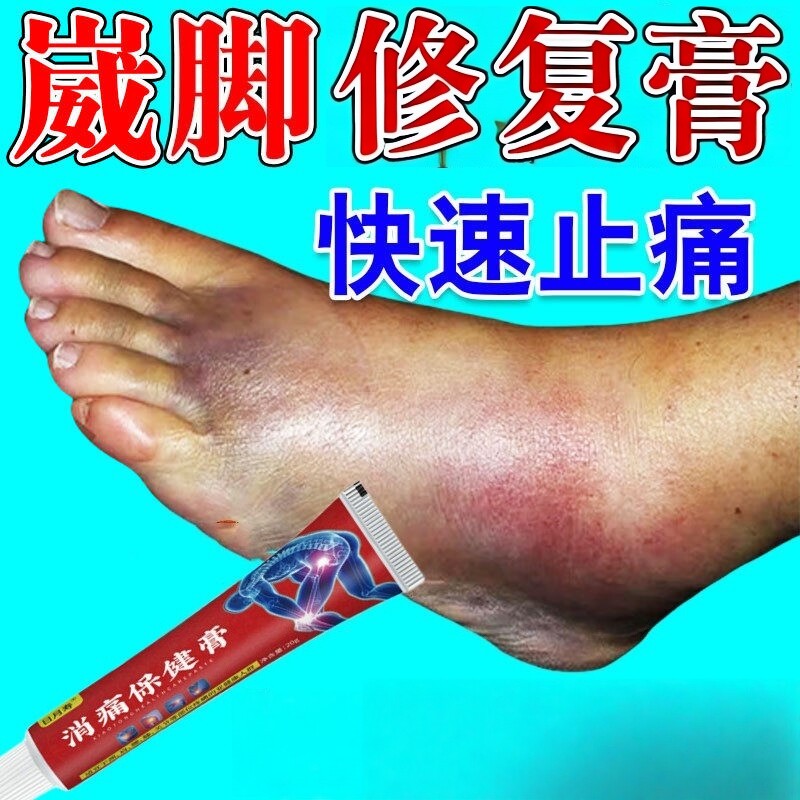 崴脚扭伤恢复药治脚脖子肿胀淤青脚腕踝走路疼消肿止痛专用