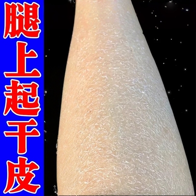 冬天皮肤干燥起皮身体乳腿部粗糙掉皮屑脱皮发痒保湿补水护肤甘油