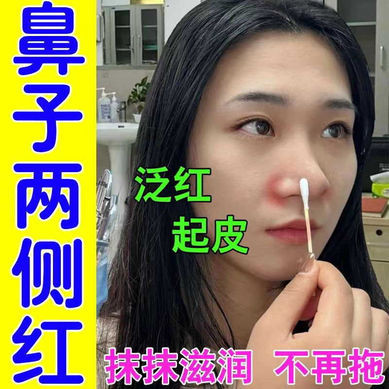 鼻子两侧发红起皮鼻子两边干燥鼻子干脱皮鼻翼两边红肿瘙痒滋润膏