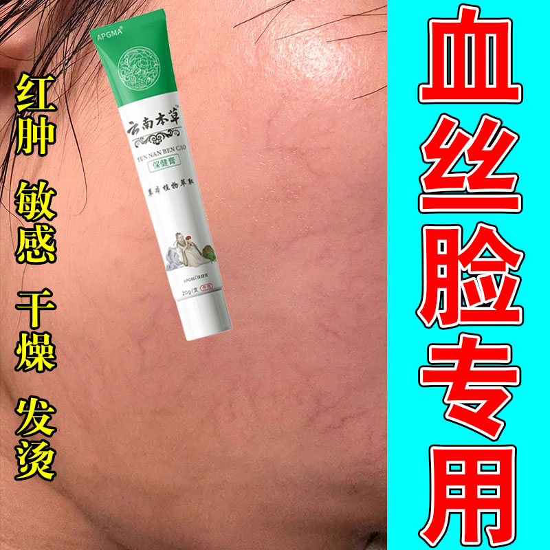 改善脸上有红血丝角质层薄修复红血丝高原红脸蛋专用草本乳霜